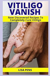 Vitiligo Vanish: وصفات سرية تم اكتشافها حديثًا لعلاج كامل من Vitiligo ، احصل على إستيم، استمتع بجلدك الناعم الشفاف مرة أخرى وغزو Vitiligo بشكل طبيعي