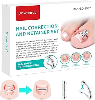 اداة تصحيح اظافر القدم النامية من خليط معدني من التيتانيوم، مجموعة ازالة اظافر القدم النامية، مصممة لاصلاح الاظافر المنحنية، مصحح اظافر القدم النامية، مناسب لمعظم المقاسات