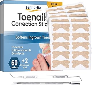 Ingrown Toenail Treatment, 50Pcs Ingrown Toenail Removal Kit with File and Lifter, Professional Ingrown Curved Toenails Correction